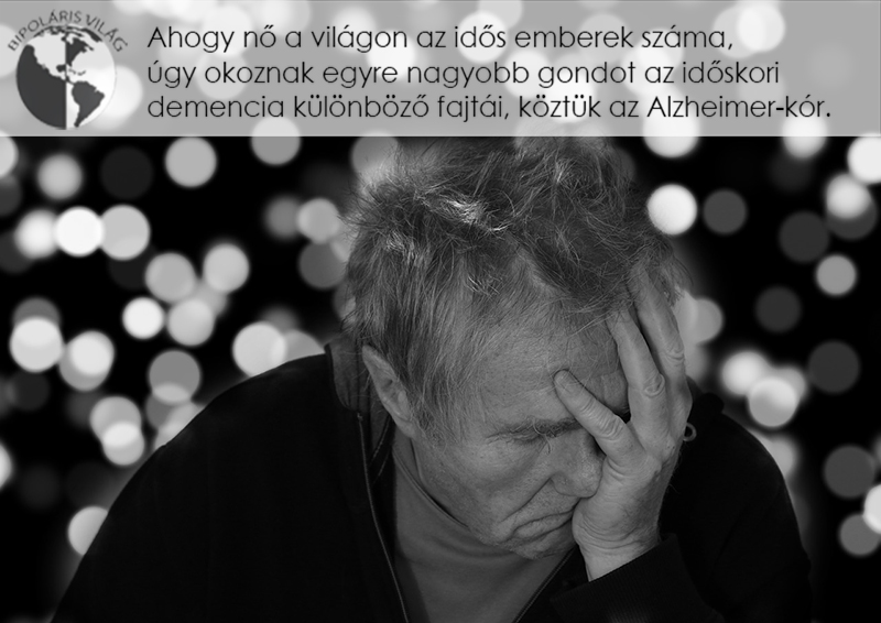 Alzheimer-kór